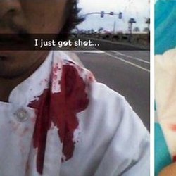 Ditembak Hingga Penuh Darah, Mahasiswa Ini Malah Selfie