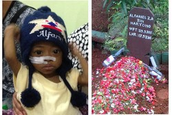 Selamat Jalan Alfariel, Balita yang Berjuang Lawan Caroli Disease