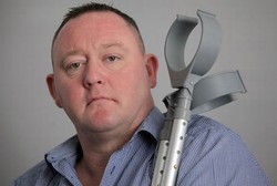 Luka Gores di Sela Jari Jadi Infeksi, Pria Ini Kehilangan Separuh Kakinya