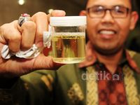 Anggota DPR Fraksi PKS Melakukan Tes Urine