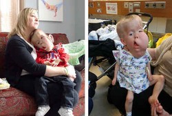 Bocah Ini Kena Penyakit yang Terjadi pada 1 dari 50 Juta Anak di Dunia