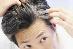 Masih Muda Tapi Rambut Sudah Beruban? Bisa Jadi Ini Sebabnya