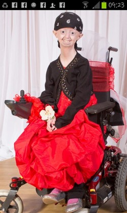 Tubuh Menua Sebelum Waktunya, Gadis Ini Meninggal di Usia 17 Tahun