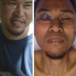 Perbekalan di Gunung Menipis yang Membuat Daeng Koro Tertangkap Densus