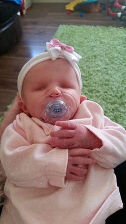 Meski Lahir Tanpa Bola Mata, Tapi Bayi Ini Sungguh Menawan