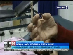 Latah Akik, Cincin Rp 2 Ribu Nyangkut di Jari Bocah Ini