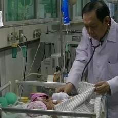 Kelainan Komplek, Kembar Siam Dempet Dada-Perut asal Sidoarjo Meninggal