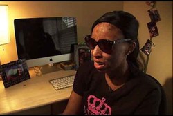 Kena Reaksi Obat, Kulit Wanita Ini Mengelupas Hingga Bagian Dalam