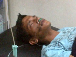 Masih Terbaring, Ini Rupa Mario Si Penyusup Pesawat Garuda Lewat Roda