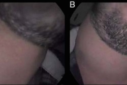 Sering Meniup Trompet, Leher Pria Ini Bisa Menggelembung Seperti Kodok