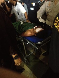 Rustam Terluka Paling Parah, Terkena Ledakan Saat Menyapu Lapangan