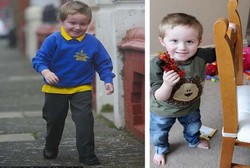 Bocah Ini Diragukan Bisa Berjalan karena Bagian Otaknya Salah Tempat