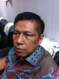 Begini Wajah Lebam Politikus PD Mulyadi Usai Dijotos Politikus PPP di DPR