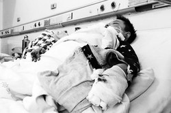 Ponselnya Meledak, Bocah Ini Luka Parah di Wajah