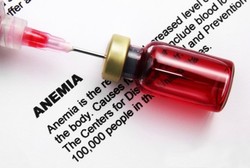 Kekurangan Zat Besi Alias Anemia? Atasi dengan Mengonsumsi 5 Asupan Ini