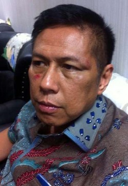 MKD: Sanksi Terberat untuk Kasus Pemukulan di Komisi VII Pemecatan