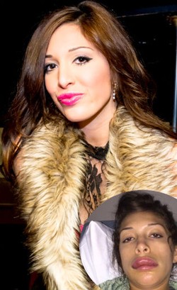 Pasca Tragedi Bibir Jontor, Bintang Porno Ini Akan Jadi Ahli Bedah Plastik