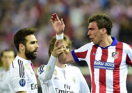 Mandzukic: Tidak Ada Gigitan dari Carvajal