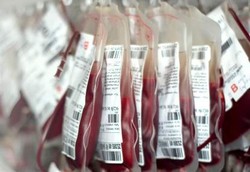 Bagi yang Rutin Transfusi Darah, Ilmuwan Sarankan Punya Donor Tetap
