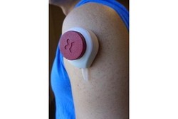 Sedang Dikembangkan! Alat Pengambil Sampel Darah Tanpa Rasa Sakit