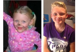 Agar Jadi Anak Laki-laki, Gadis Ini Jalani Terapi Hormon di Usia 10 Tahun