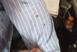 Tusuk Orang Sebelah Pakai Pulpen, Penumpang Diusir dari Pesawat