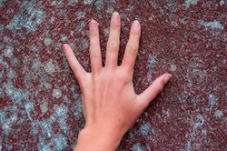 Jaringan Kuku yang Mati Belum Copot, Kuku Tak Akan Tumbuh Menumpuk