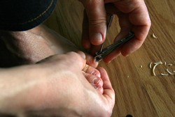 Awas! Malas Merawat Kuku Kaki Risikonya Bisa Cantengan