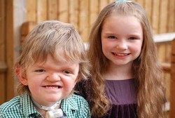 Kepalanya Dibingkai dan 50 Kali Operasi, Billy Akhirnya Punya Wajah Baru