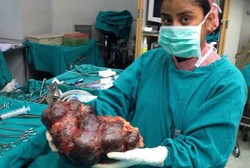 Infeksi Parah, Ginjal Pria Ini Membesar Hingga Seberat Bayi