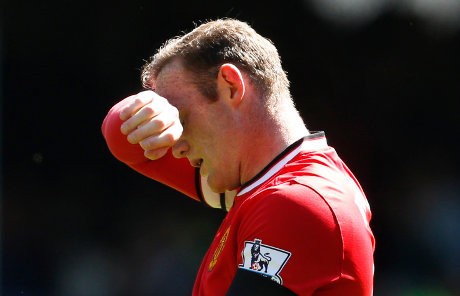 Rooney Alami Cedera Lutut