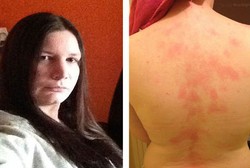 Tak Pernah Dicium, Istri Pria Ini Ternyata Alergi Air Parah