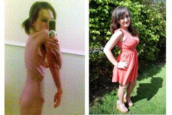 Sempat Berbobot 24 Kg karena Idap Anoreksia, Kini Megan Sukses Jadi Model