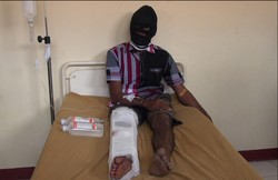 Kaki Kanan Kena Tembak, Ini Penampakan Pria yang Diduga Eksekutor 2 Intel Kodim