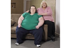 Asup 13.000 Kalori Sehari, Bobot Gadis Ini Capai 349 Kg di Usia 22 Tahun