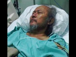 Pepeng Meninggal karena Komplikasi