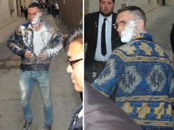 Duh! Adam Levine Tiba-tiba Diserang dengan Gula Halus oleh Orang Iseng