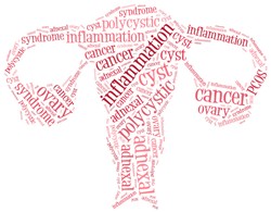 Kenali, Gejala Kanker Ovarium yang Umumnya Muncul Saat Sudah Stadium Lanjut