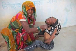 Kondisi Langka, Leher Bocah Ini Selalu Menggantung dan Tak Bisa Tegak