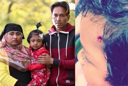 Kepala Tertembak Senapan Angin, Bocah Ini Diselamatkan Rambut Tebalnya