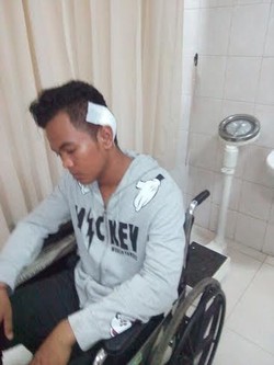 Terlibat Perkelahian, Dudung Ditusuk Senjata Tajam di Kepala