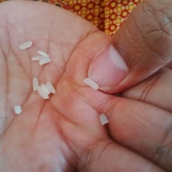 Bahaya! Efek Makan Beras Plastik dari Sakit Perut hingga Kanker