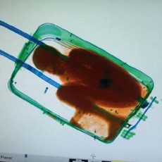 Diselundupkan ke Spanyol dalam Koper, Bocah Afrika Boleh Tinggal