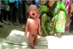 Astaga! Bayi Dua Hari Dipaksa Berjalan oleh Dukun Agar Panasnya Turun