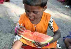 Atasi Gizi Buruk dan Anemia pada Anak, Kabupaten Bantul Bikin Terobosan