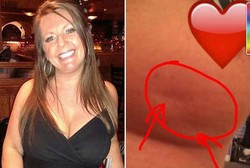 Upload Foto Buah Dada, Lisa Ingin Wanita Tak Abaikan Risiko Kanker