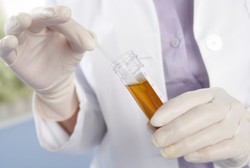 Urine Berwarna Kemerahan Seperti Tercampur Darah, Bisa Jadi Ini Sebabnya