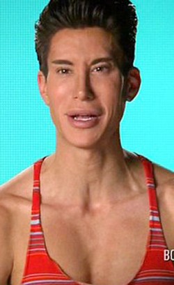 Foto: Pria yang Terobsesi Mirip Ken Barbie Jalani Operasi Pasang Sayap