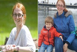 Selalu Terlihat Mabuk, Ibu Dua Anak Ini Ternyata Idap Sakit Langka