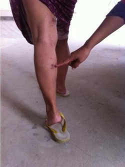 Hiii! Rusun Daan Mogot Diserbu Tomcat, Beberapa Penghuni Alami Kulit Melepuh